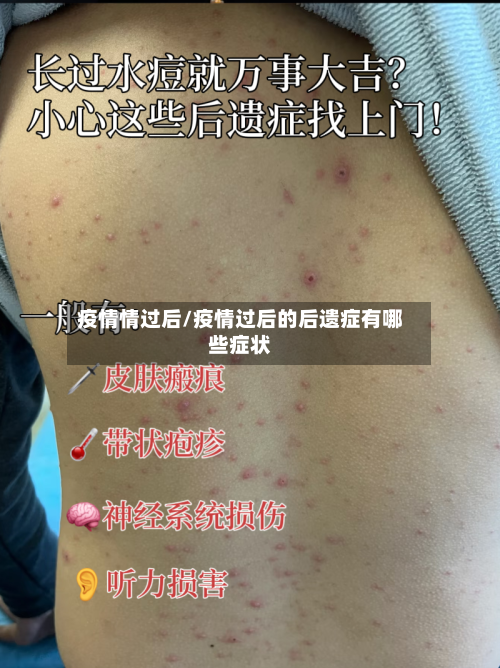 疫情情过后/疫情过后的后遗症有哪些症状