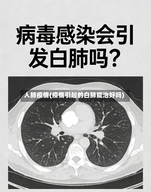 人肺疫情(疫情引起的白肺能治好吗)