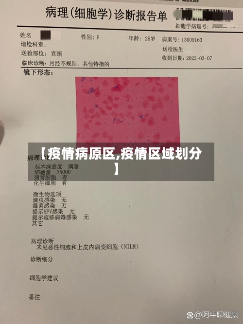 【疫情病原区,疫情区域划分】-第2张图片