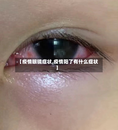 【疫情眼镜症状,疫情阳了有什么症状】