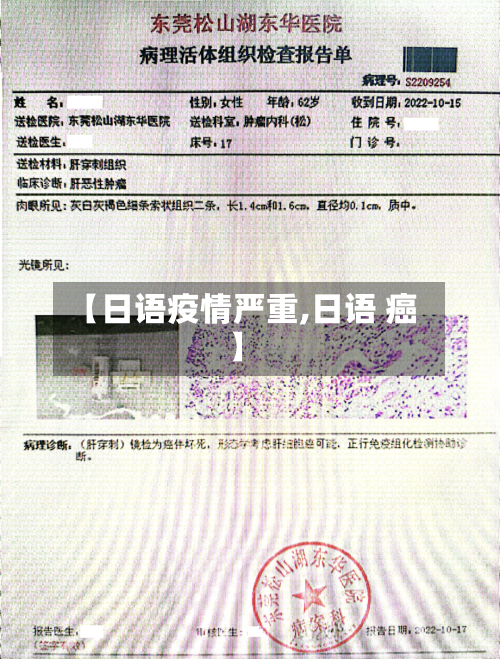 【日语疫情严重,日语 癌】