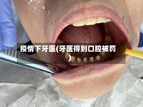 疫情下牙医(牙医得到口腔被罚)