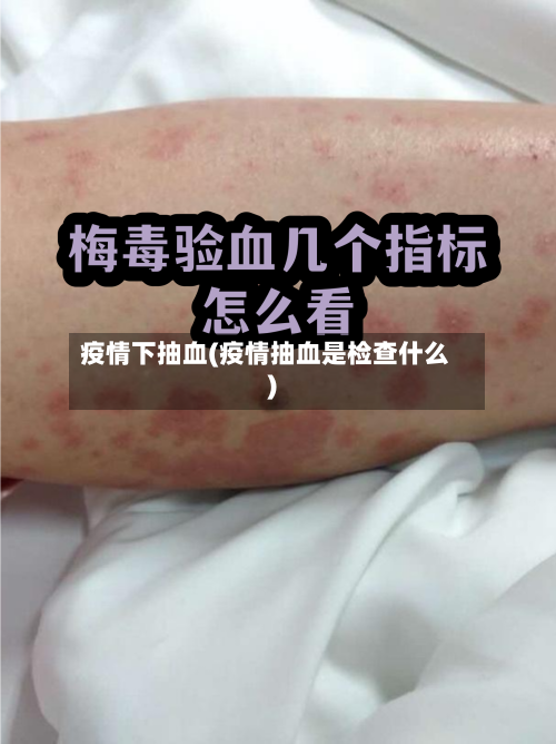 疫情下抽血(疫情抽血是检查什么)-第2张图片