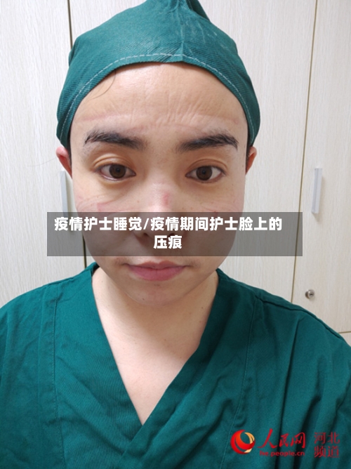 疫情护士睡觉/疫情期间护士脸上的压痕-第2张图片